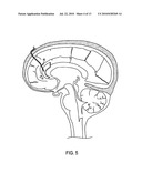 CORPUS CALLOSUM NEUROMODULATION ASSEMBLY diagram and image