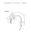 MODULAR PERCUTANEOUS VALVE STRUCTURE AND DELIVERY METHOD diagram and image