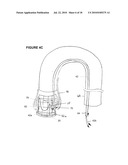 MODULAR PERCUTANEOUS VALVE STRUCTURE AND DELIVERY METHOD diagram and image