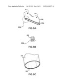 MODULAR PERCUTANEOUS VALVE STRUCTURE AND DELIVERY METHOD diagram and image