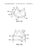 MODULAR PERCUTANEOUS VALVE STRUCTURE AND DELIVERY METHOD diagram and image