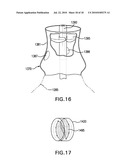 MODULAR PERCUTANEOUS VALVE STRUCTURE AND DELIVERY METHOD diagram and image