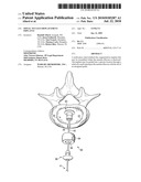 SPINAL NUCLEUS REPLACEMENT IMPLANTS diagram and image