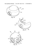 SPINAL NUCLEUS REPLACEMENT IMPLANTS diagram and image