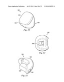 SPINAL NUCLEUS REPLACEMENT IMPLANTS diagram and image