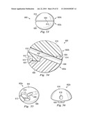 SPINAL NUCLEUS REPLACEMENT IMPLANTS diagram and image