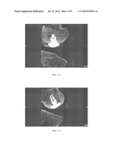 Nanorough Alloy Substrate diagram and image