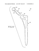 MODULAR ORTHOPAEDIC COMPONENT CASE diagram and image