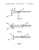 DEVICE FOR MEASURING A FLUID FLOW VELOCITY AND DIRECTION diagram and image