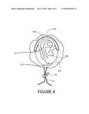 EAR COVER WITH DRAWSTRING AND CONCENTRIC RESILIENT AURAL HELIX HANGER diagram and image