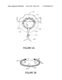 EAR COVER WITH DRAWSTRING AND CONCENTRIC RESILIENT AURAL HELIX HANGER diagram and image