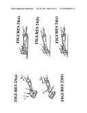 ICE SCRAPER diagram and image