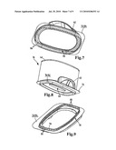 Filter mechanism for internal combustion engines diagram and image