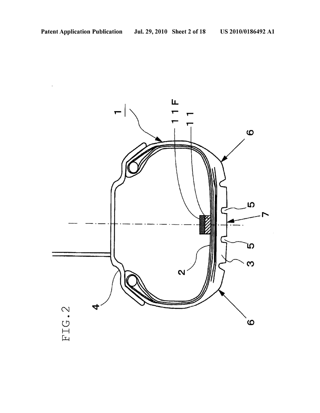 METHOD FOR ESTIMATING THE WEAR OF A TIRE - diagram, schematic, and image 03