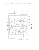 FRICTION DAMPING SYSTEM FOR A RAILWAY TRUCK diagram and image