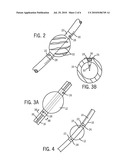 MEDICAL DEVICE AND TECHNIQUE FOR USING THE SAME diagram and image