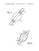 MEDICAL DEVICE AND TECHNIQUE FOR USING THE SAME diagram and image