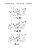 STRUCTURED FORMING FABRIC, PAPERMAKING MACHINE AND METHOD diagram and image