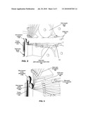 MULTI-WIRE ELECTRON DISCHARGE MACHINE diagram and image