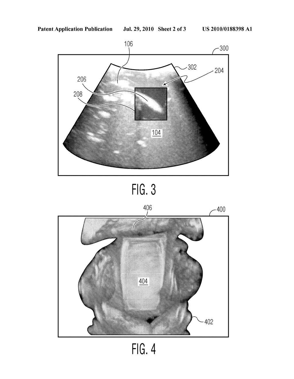 X-RAY TOOL FOR 3D ULTRASOUND - diagram, schematic, and image 03