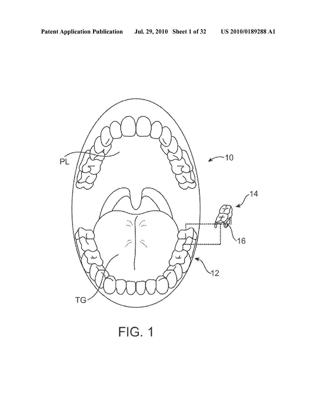 ACTUATOR SYSTEMS FOR ORAL-BASED APPLIANCES - diagram, schematic, and image 02