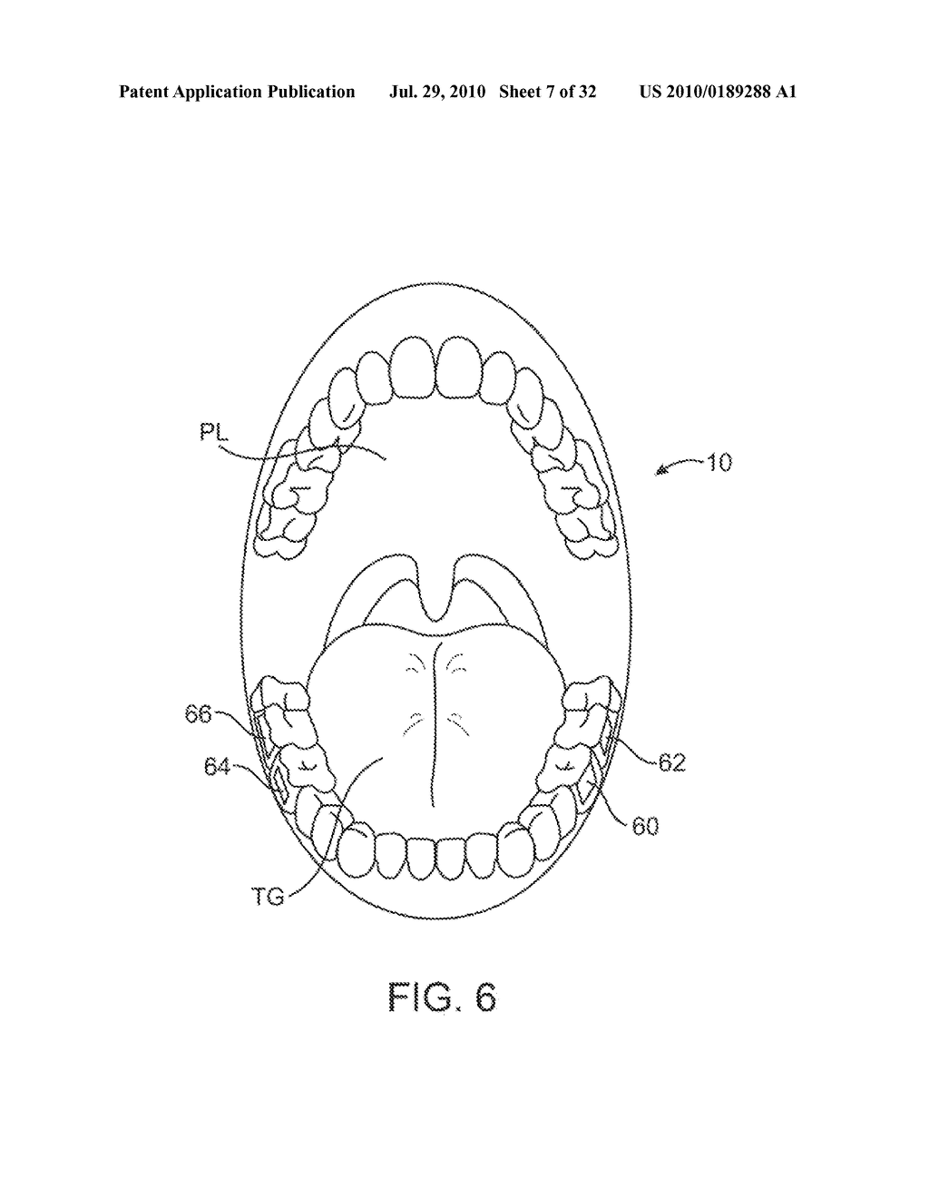 ACTUATOR SYSTEMS FOR ORAL-BASED APPLIANCES - diagram, schematic, and image 08