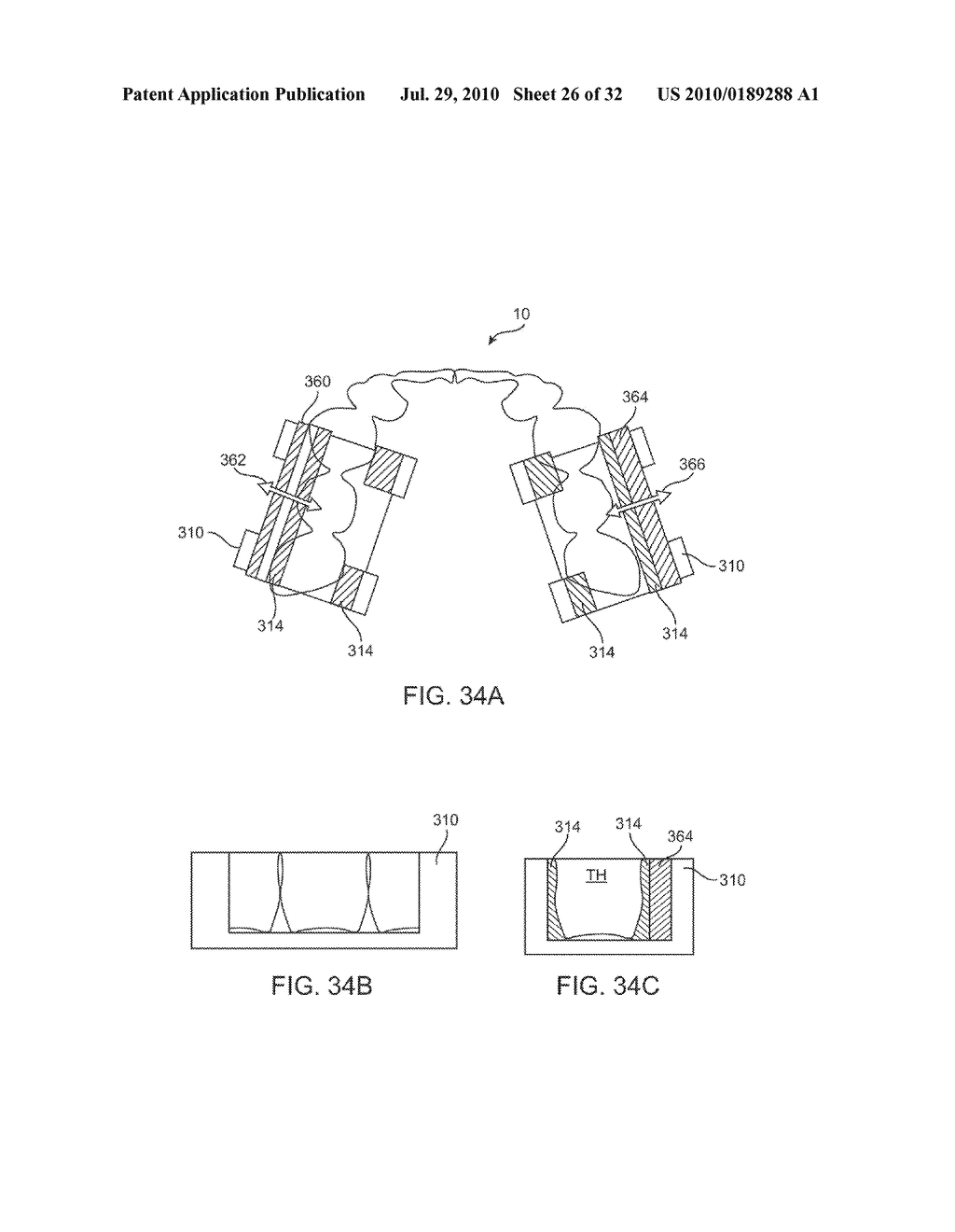 ACTUATOR SYSTEMS FOR ORAL-BASED APPLIANCES - diagram, schematic, and image 27