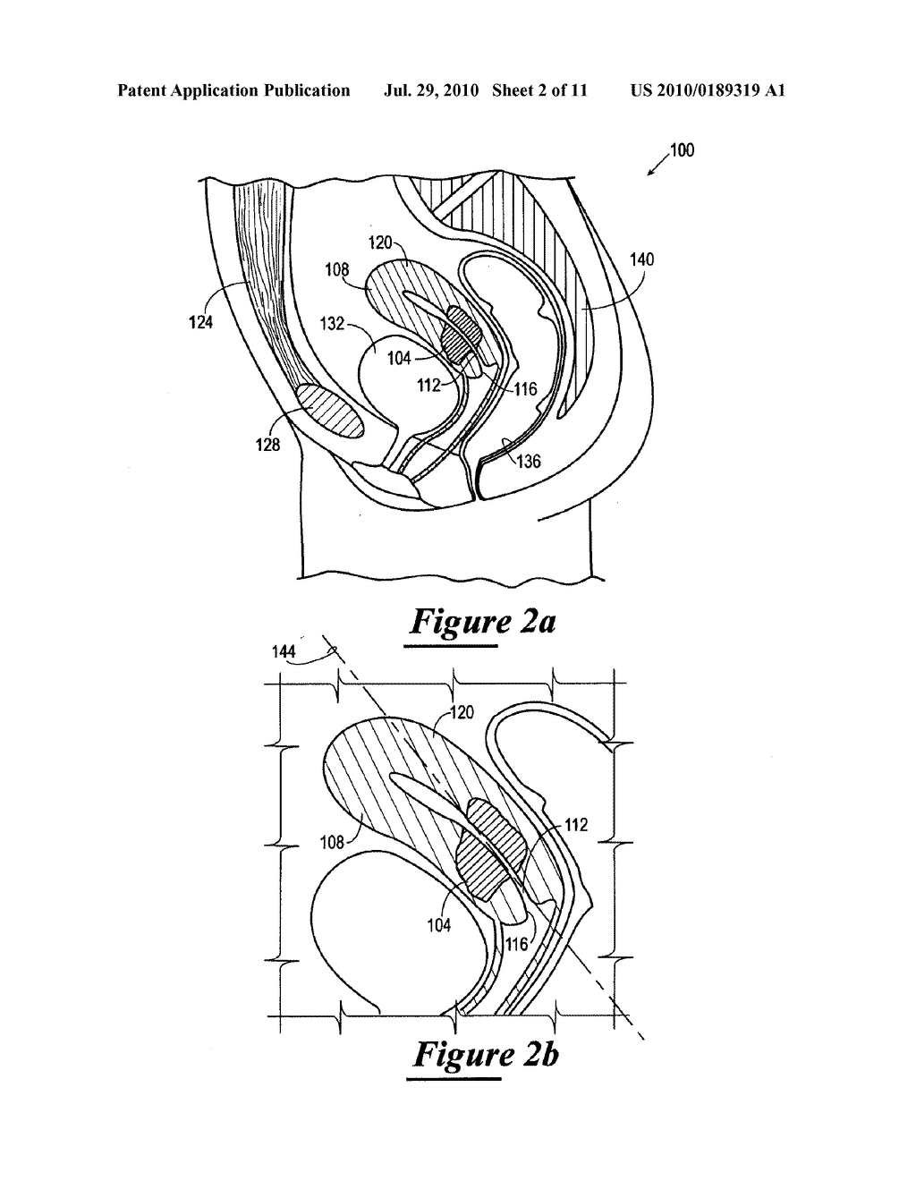 IMAGE SEGMENTATION SYSTEM AND METHOD - diagram, schematic, and image 03