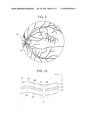 FUNDUS OCULI OBSERVATION DEVICE, FUNDUS OCULI IMAGE PROCESSING DEVICE, AND FUNDUS OCULI OBSERVATION METHOD diagram and image