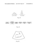 ULTRASOUND IMAGE ENHANCEMENT AND SPECKLE MITIGATION METHOD diagram and image