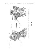 METHODS FOR TREATING HEADACHE diagram and image