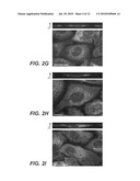 METHODS FOR THE DETECTION OF FATTY-ACYLATED PROTEIN diagram and image