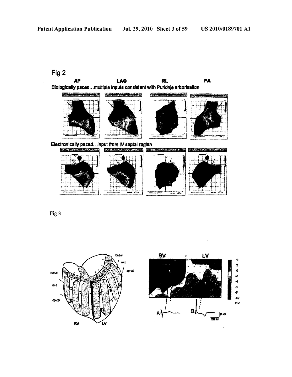 METHODS AND COMPOSITIONS TO TREAT ARRHYTHMIAS - diagram, schematic, and image 04