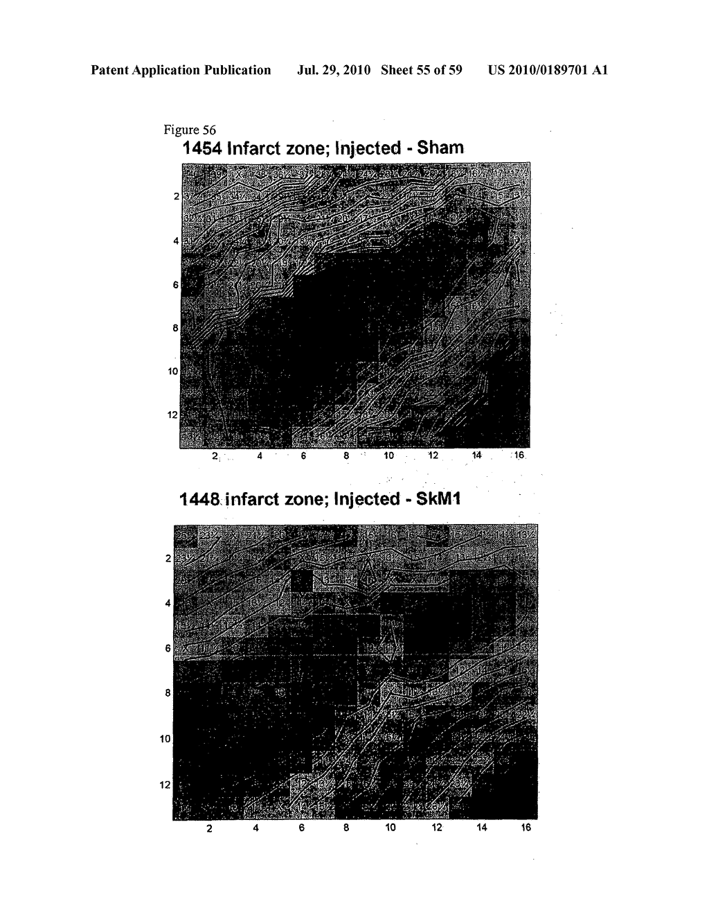 METHODS AND COMPOSITIONS TO TREAT ARRHYTHMIAS - diagram, schematic, and image 56