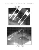 IN VIVO GENE TRANSFER METHODS FOR WOUND HEALING diagram and image