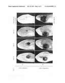 Use of an ozone / oxygen mixture as a primary anticancer therapy via intraperitoneal insufflation diagram and image