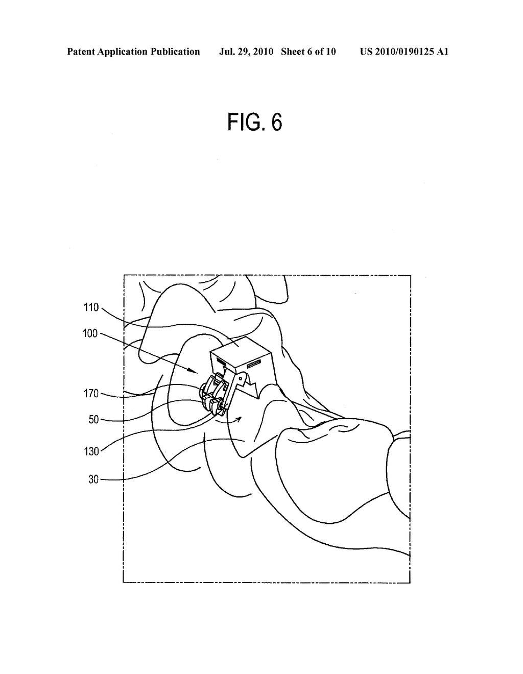 TRANSFER JIG FOR BRACKET OR TUBE, MANUFACTURING AND USING METHOD THEREOF - diagram, schematic, and image 07