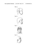 NASAL AND MAXILLARY GROWTH ENHANCER diagram and image