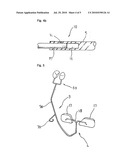 NASAL AND MAXILLARY GROWTH ENHANCER diagram and image