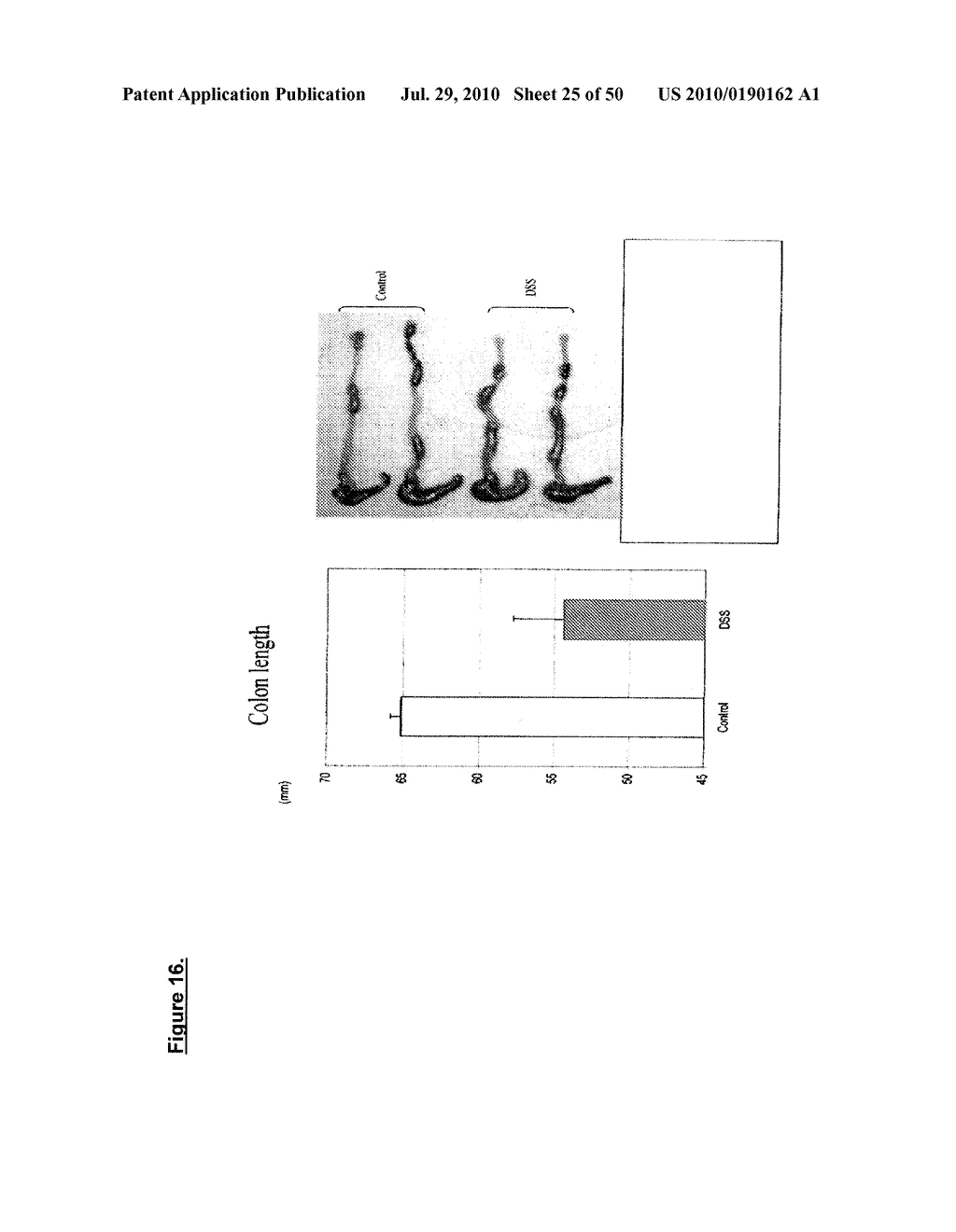 METHODS OF USING SINGLE NUCLEOTIDE POLYMORPHISMS IN THE TL1A GENE TO PREDICT OR DIAGNOSE INFLAMMATORY BOWEL DISEASE - diagram, schematic, and image 26