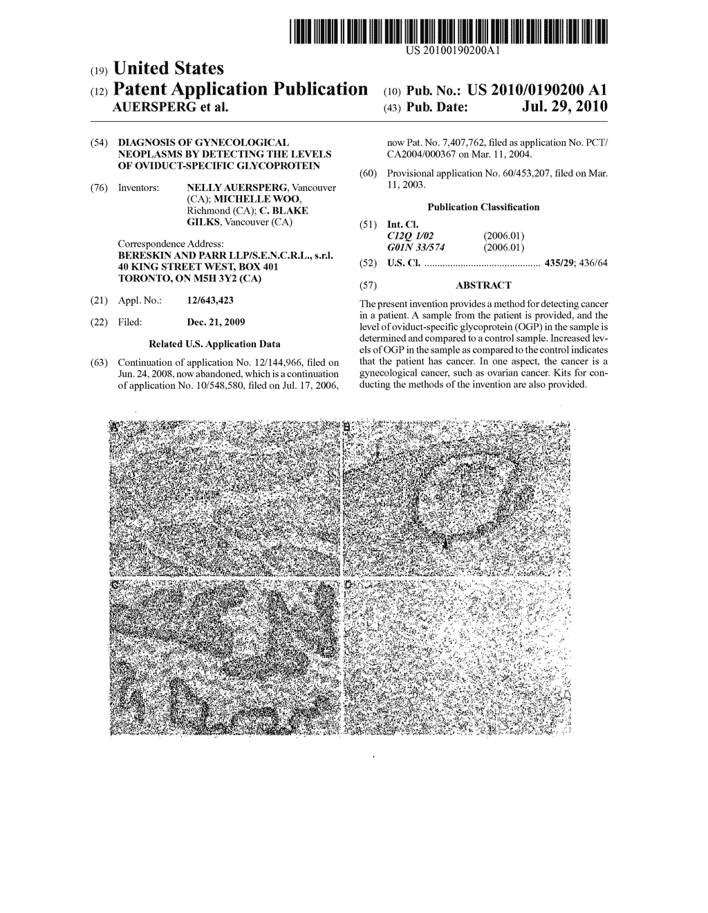 Diagnosis of Gynecological Neoplasms By Detecting The Levels of Oviduct-Specific Glycoprotein - diagram, schematic, and image 01