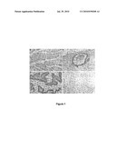 Diagnosis of Gynecological Neoplasms By Detecting The Levels of Oviduct-Specific Glycoprotein diagram and image