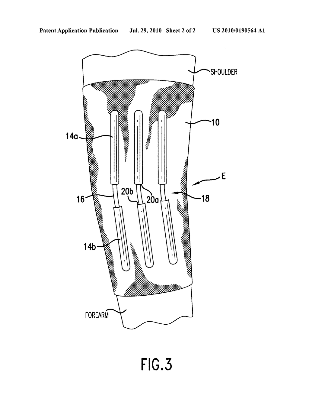 Golf support sleeve - diagram, schematic, and image 03