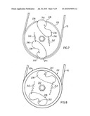 Vibration Compensating Pulley diagram and image