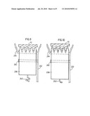 Vibration Compensating Pulley diagram and image