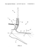 Cervix Examination device and cervix examination set diagram and image