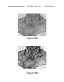 SYSTEM AND METHOD FOR USING THREE DIMENSIONAL INFRARED IMAGING TO PROVIDE PSYCHOLOGICAL PROFILES OF INDIVIDUALS diagram and image