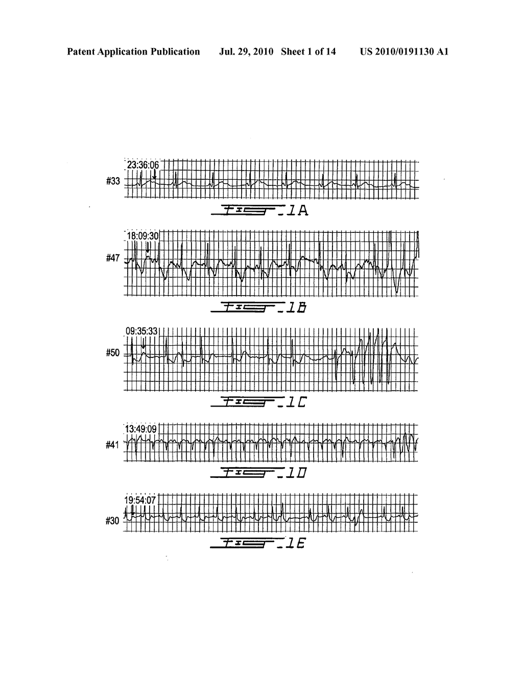 METHOD FOR DETECTING PATHOLOGIES USING CARDIAC ACTIVITY DATA - diagram, schematic, and image 02