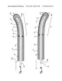 Guidewire diagram and image