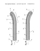 Guidewire diagram and image